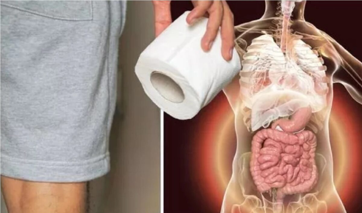 Primul semn neobișnuit de cancer de colon, potrivit medicilor