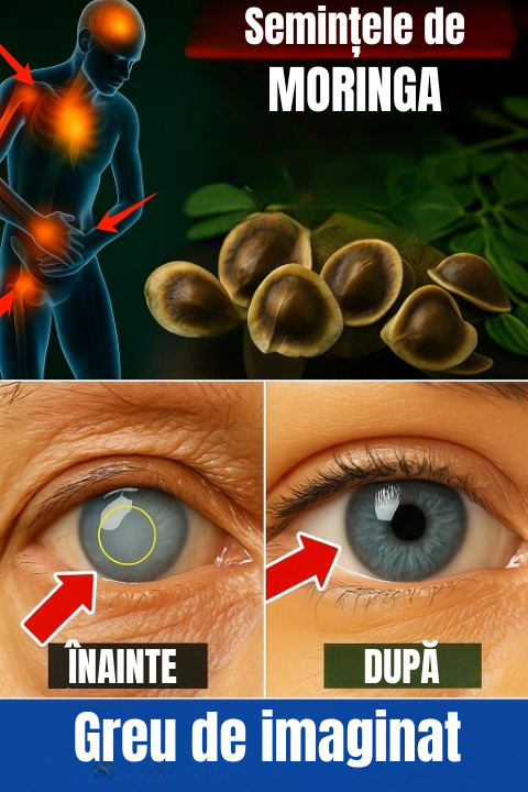 12 beneficii ale semințelor de moringa pe care nu le vei auzi niciodată de la medic