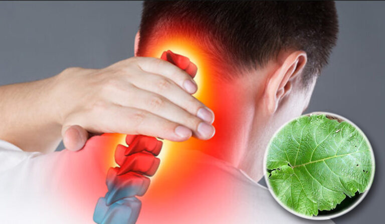 Planta fara efecte secundare, care te scapa de durerile cauzate de spondiloza cervicala