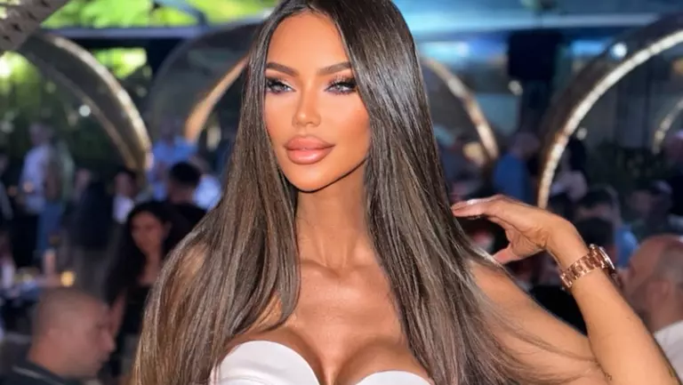 Imagini cu Bianca Drăgușanu la o lună după ce și-a modificat buzele. „O să mă operez până o să arăt ca și filtrele, pe banii mei”