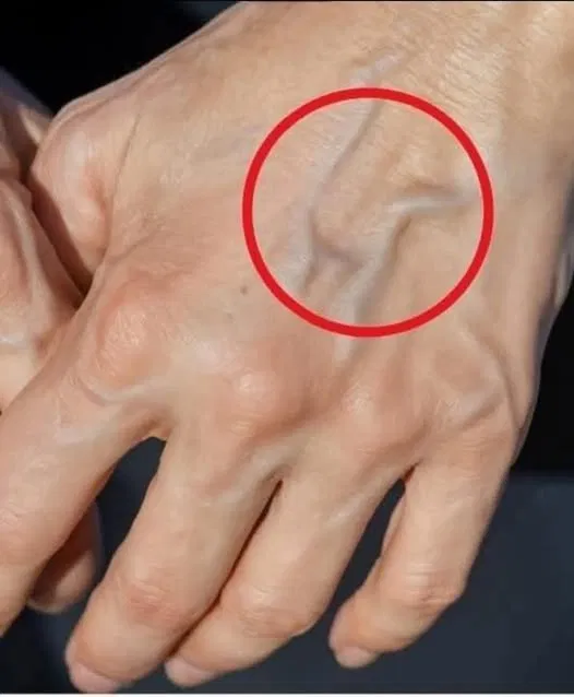 Remedii naturale pentru îmbunătățirea sănătății pielii