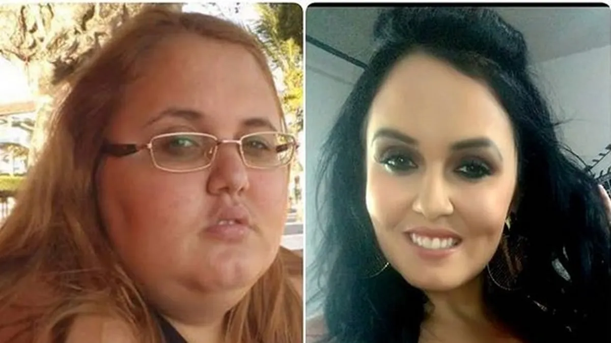 Incredibil, dar adevarat! O tanara a slabit 88 de kilograme! Cum a reusit femeia si cum arata acum